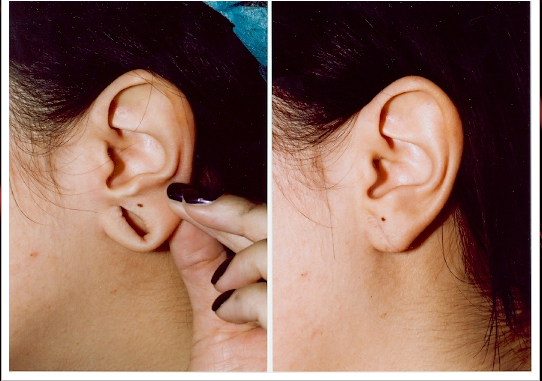 Tvak Skin and Laser Clinic
