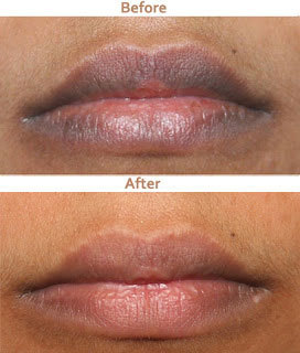 Tvak Skin and Laser Clinic