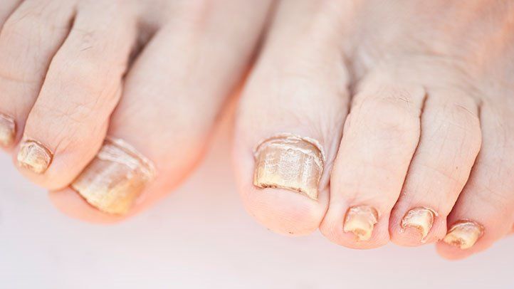 Reason For Skin Growth Under Nails | POPSUGAR Beauty UK